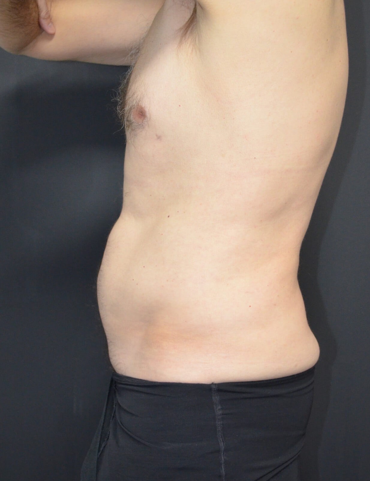 After Image