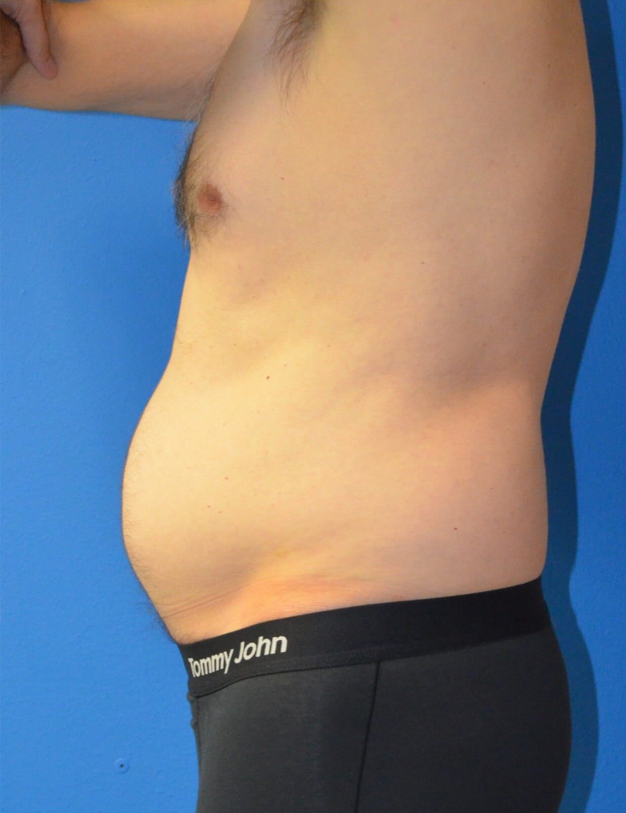 Before Image
