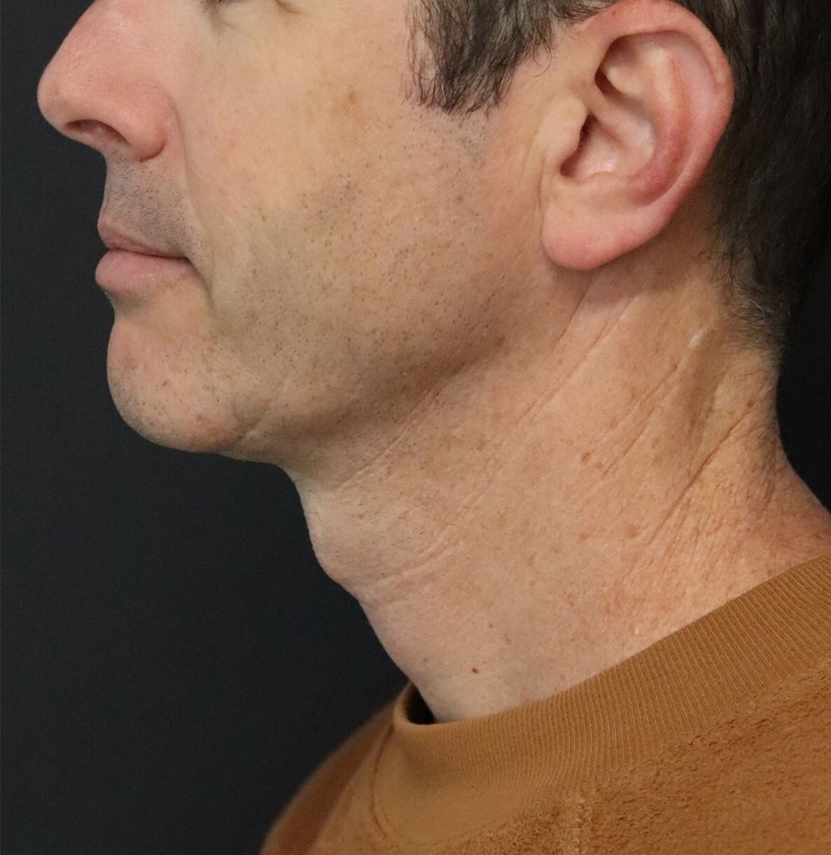 After Image