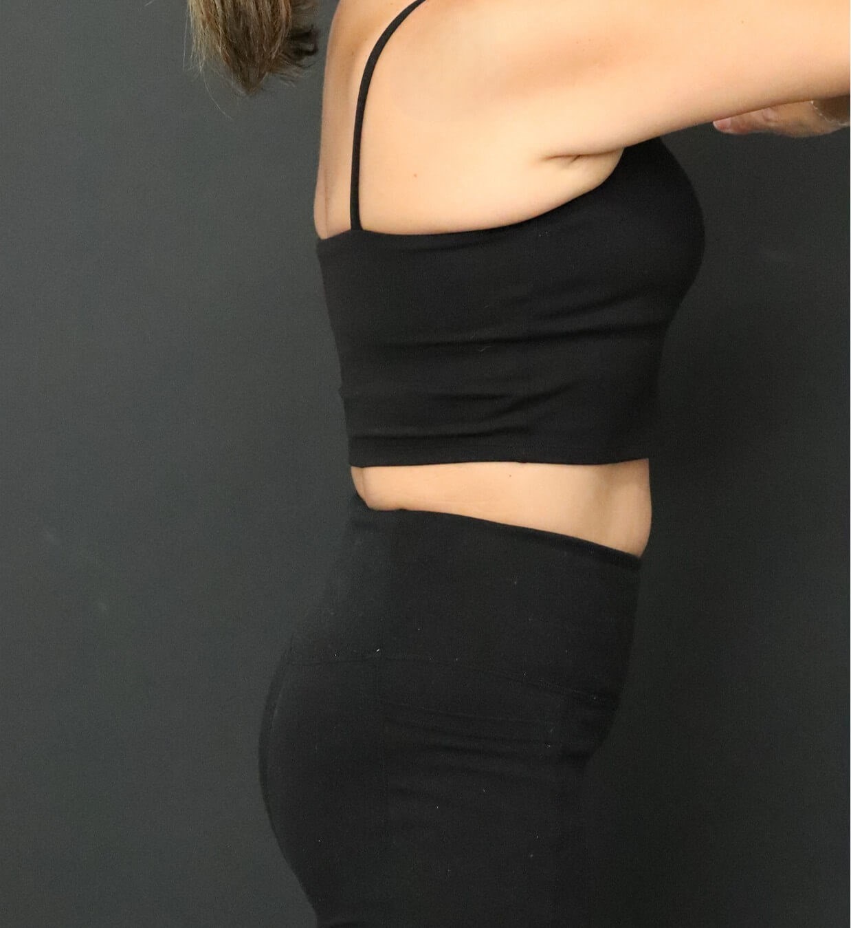Weight loss with Semaglutide After