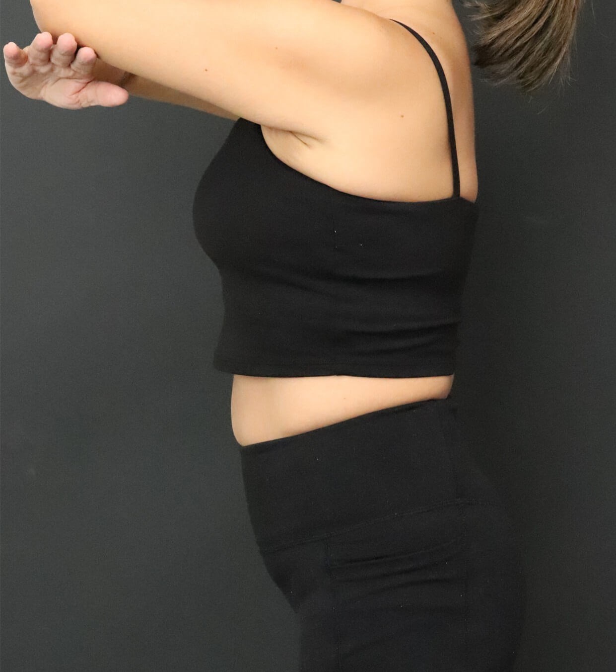 Weight loss with Semaglutide After