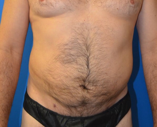 After Image