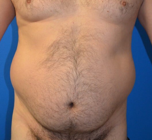 Before Image