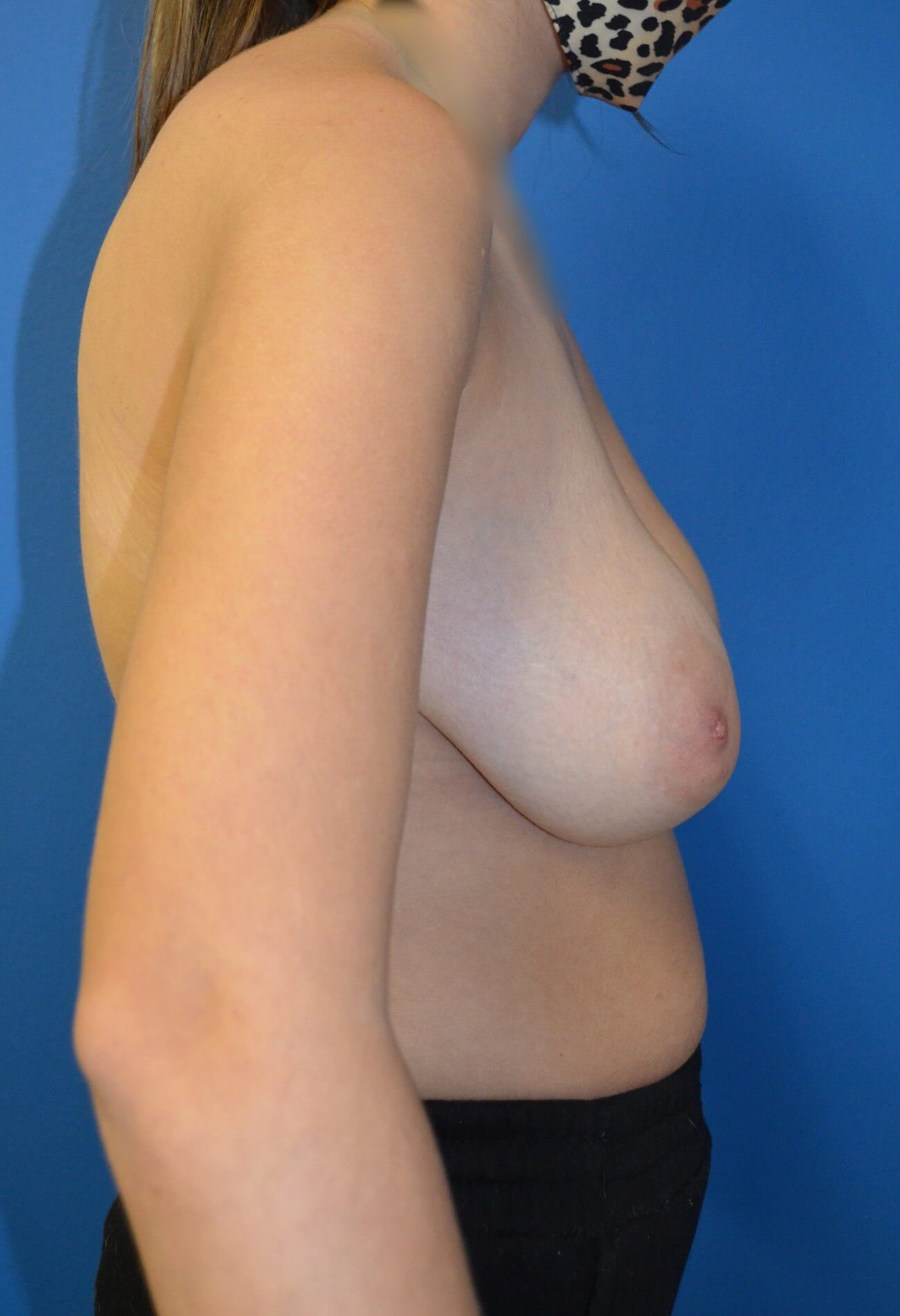 Improvements in posture Before