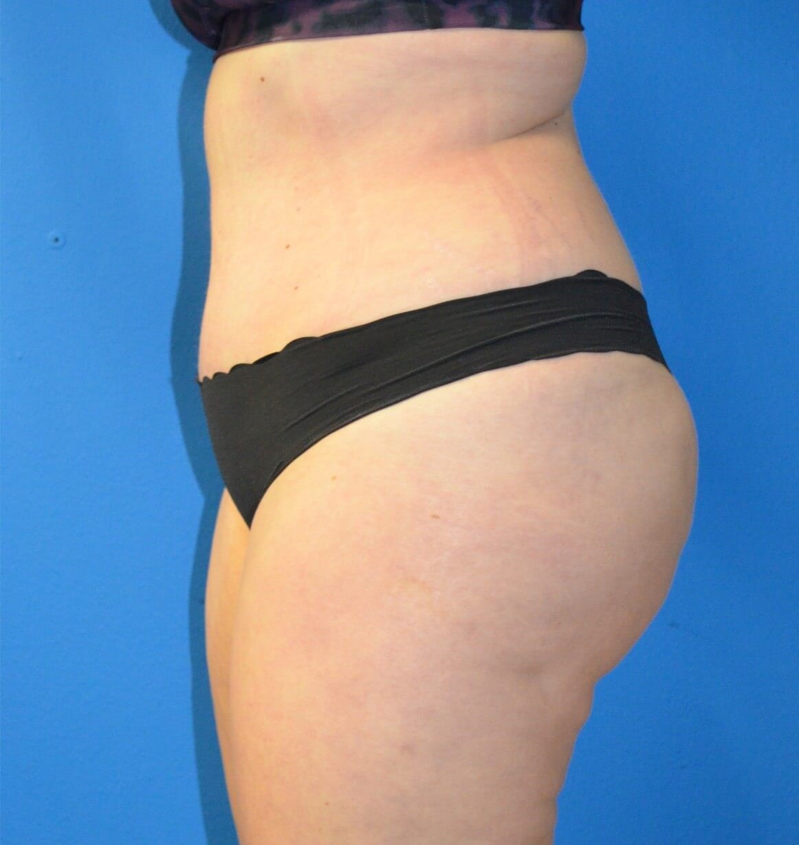 After Image