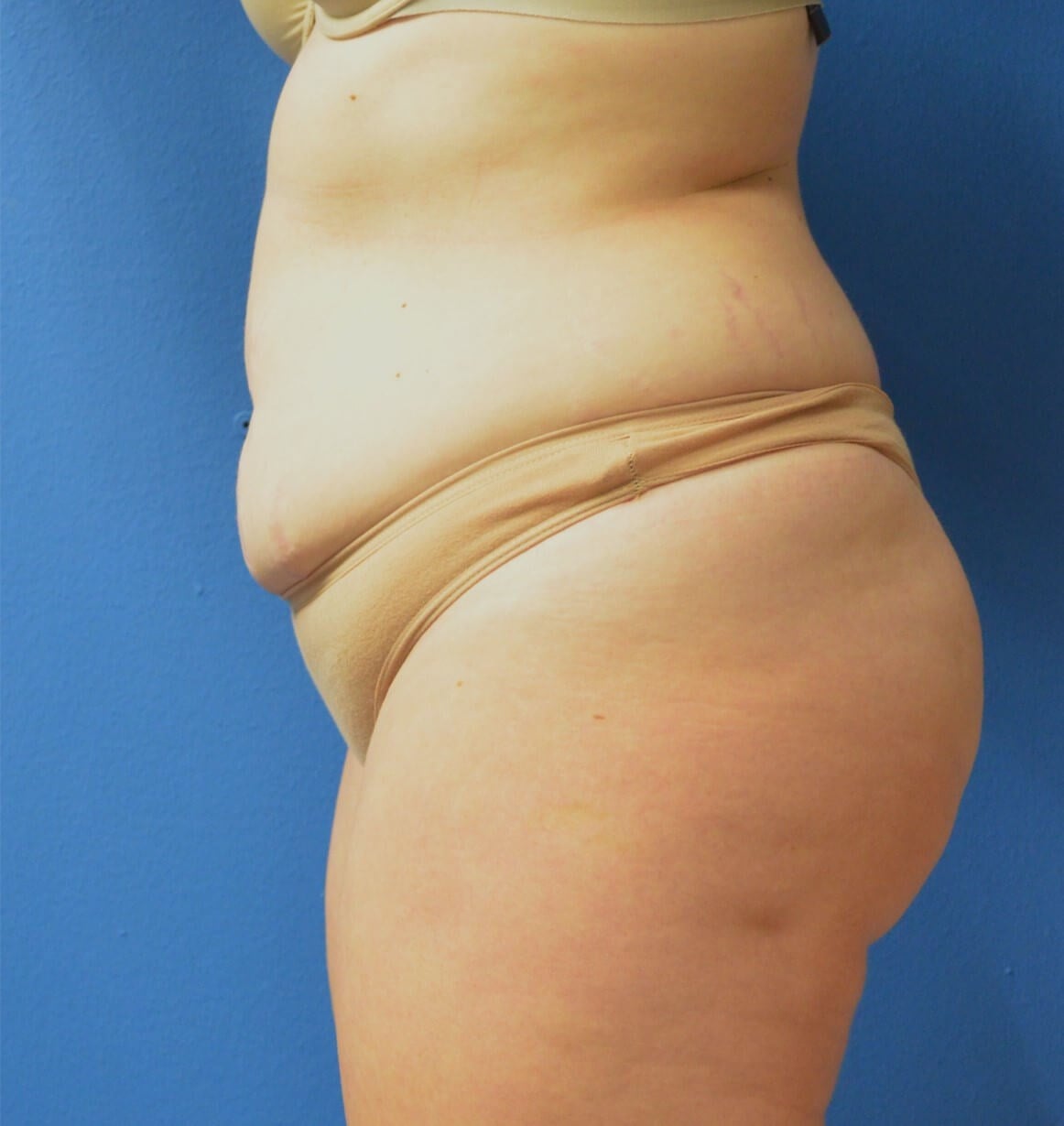 Before Image